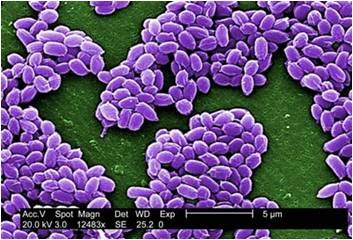 http://www.scientistlive.com/media/images/012508_anthrax_new.jpg